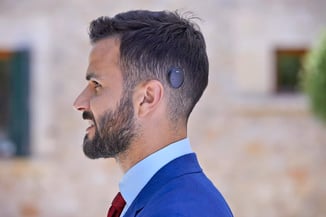 Cochlear_Mallorca_Day_2_154