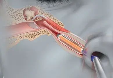 ETD-Patient-Brochure-5-640w.jpg